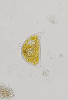 Cystodinium cornifax je vzácně se vyskytující kokální zástupce jinak  běžně pohyblivých obrněnek, který  se ojediněle nachází v planktonu nebo  přisedlý k substrátu v čistých biotopech s makrovegetací. Foto J. Kaštovský