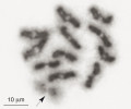 Metafáze prvního meiotického dělení buněk z varlat samce ostníka šesti­skvrnného (Ero aphana) s 11 chromozomovými páry  v bivalentech. Šipka označuje dva  pohlavní chromozomy X1 a X2, které jsou v tomto období meiózy výrazně  despiralizované (dekondenzované),  tedy po nabarvení méně kontrastní. Chromozom Y samcům rodu Ero chybí. Foto M. Kotz
