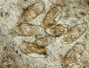 Příklady parazitů, u nichž byl studován vliv na roztroušenou sklerózu. Vajíčka motolice krevničky střevní (Schistosoma mansoni) – nativní roztlakový preparát. Foto T. Macháček 
