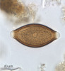 Příklady parazitů, u nichž byl studován vliv na roztroušenou sklerózu. Vajíčka hlístice tenkohlavce prasečího (Trichuris suis). Foto T. Macháček