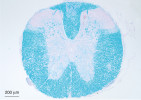 Myelin obaluje a chrání nervová vlákna, při jeho úbytku dochází  k poruchám v přenosu nervového  vzruchu. Na snímku histologický řez míchou myši, myelin označen luxolovou modří. Foto T. Macháček