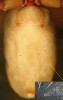 Spodní strana zadečku samice šestiočky sadistické (Harpactea sadistica). Po stranách jsou vidět krátké příčné rezavé jizvy po proniknutí samčího kopulačního orgánu. Na detailu ze skenovacího elektronového  mikroskopu je jedna jizva zvětšena. Foto M. Řezáč
