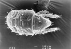 Vybraní typičtí zástupci mikro- (bakterie, houby, prvoci, hlístice), mezo- (chvostoskoci, roztoči a roupice) a makroedafonu (larvy much, mnoho­nožky). Roztoč. Foto J. Starý