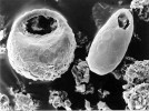 Vybraní typičtí zástupci  mikro- (bakterie, houby, prvoci, hlístice), mezo- (chvostoskoci, roztoči a roupice) a makroedafonu (larvy much, mnoho­nožky). Krytenka. Foto V. Balík. 