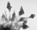 Mnohobuněčné zďovité nepohlavní spory (konidie) druhu Phragmotrichum chailletii. Ačkoli se tento nápadný druh na jaře běžně vyskytuje na smrkových šiškách v opadu, není dosud známa  žádná sekvence jeho DNA, tudíž ani postavení v systému vřeckovýtrusných hub (Ascomycota). Foto O. Koukol