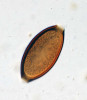 Nerýhované vajíčko tenkohlavce  (Trichuris sp.). Vajíčko se stává infekčním až po vyvinutí prvního larválního stadia (L1), které je obsaženo v komerčním  přípravku TSO. Velikost vajíčka  60–65 μm. Foto D. Modrý