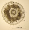 Mykorhizní struktury (klubíčka hyf) v kořenových buňkách pětiprstky (Gymnadenia). Mykorhiza vypadá u všech orchidejí podobně a houby nelze identifikovat podle tvaru mykorhizních struktur, spolehlivější určení nabízí sekvenace úseků houbové DNA. Foto T. Těšitelová