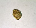 Samčí mikrospora šídlatky jezerní. Foto M. Čtvrtlíková