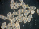 Parazitické larvy (glochidia) škeblice asijské dosahují velikosti 400 μm.  Pro dokončení vývoje potřebují hostitelskou rybu, která je zároveň efektivní  vektor jejich šíření. Foto K. Douda