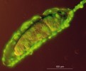 Specializované imunitní buňky – lamelocyty obklopující vajíčko parazitoida – jsou patrné díky zelenému fluorescenčnímu signálu. Vajíčko obalené  lamelocyty bylo získáno pitvou z larvy infikované octomilky. Foto T. Doležal, upraveno podle: A. Bajgar a kol. (2015)