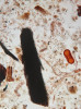 Mikrofotografie vzorku sedimentu s pylovým zrnem miříkovité rostliny (Apiaceae) a různě velkými uhlíky, které jsou dokladem někdejšího lesního požáru. Foto P. Pokorný