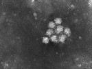 Viry představují skupinu vnitro­buněčných parazitů, u nichž byl zatím popsán jen zlomek existujících druhů. Na snímku viriony nového nepopsaného flaviviru. Foto D. Krsek a K. Majerová