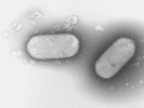 Nově popsaná tyčinkovitá bakterie Hymenobacter amundsenii pocházející z Antarktidy, z okolí české Mendelovy polární stanice umístěné na ostrově Jamese Rosse. Foto D. Krsek