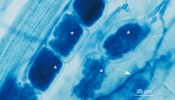 Arbuskulárně mykorhizní houby v kořenu hostitele. Houbové struktury jsou silně obarvené trypanovou modří, přirozeně jsou bezbarvé. Vidíme arbuskuly (označené *) a hyfové závity (s) uvnitř buněk hostitele a mezibuněčné mycelium (šipky). Foto J. Jansa