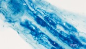 Arbuskulárně mykorhizní houby v kořenu hostitele. Houbové struktury jsou silně obarvené trypanovou modří, přirozeně jsou bezbarvé. Vidíme arbuskuly (označené *) a hyfové závity (s) uvnitř buněk hostitele a mezibuněčné mycelium (šipky). Foto J. Jansa