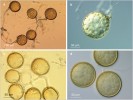 Spory různých druhů arbuskulárně mykorhizních hub: Gigaspora margarita (a), Funneliformis mosseae (b),  Rhizophagus irregularis (c),  Claroideoglomus claroideum (d). Foto J. Jansa
