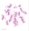 Profáze prvního meiotického dělení u štěnice domácí. Postpachytene – chromozomy postupně kondenzují z difuzního stadia. Měřítko 5 μm. Foto D. Sadílek