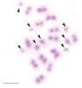 Invertovanou meiózu lze  u štěnice dobře pozorovat zejména v metafázi druhého meiotického dělení samců. Jednochromatidové pohlavní chromozomy (označeno) jsou obklopeny 13 páry dvouchromatidových autozomů. Samčí figury na snímcích se liší systémem pohlavních chromozomů. Na obrázku 2n = 34, X1–7Y. Měřítko 5 μm. Foto D. Sadílek