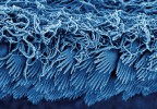 Mikrofotografie povrchu skolexu (mikrotrichy) tasemnice rodu Echinobothrium z rejnoka rodu Pastinachus, Indonésie. Skenovací elektronový  mikroskop, zvětšeno 10 000 ×. Foto R. Kuchta