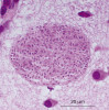 Tkáňová cysta Toxoplasma gondii na histologickém řezu. Foto K. Blažek