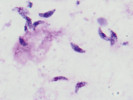 Tachyzoiti mají „lukovitý“ tvar, podle nějž dostala toxoplazma do svého jména Toxo, z řeckého toxon – luk. Foto J. Votýpka