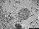 Toxoplasma gondii – tkáňová cysta z mozku laboratorní myši. Foto D. Krsek a P. Kodym
