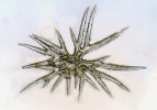 Bohatě větvené hvězdicovité trichomy tařice horské (Alyssum montanum). Snímek H. Mašková