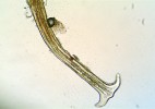 Kotvicovité trichomy hořčíku  jestřábníkovitého (Picris hieracioides).  Snímek H. Mašková