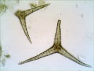 Trýzel škardolistý (Erysimum crepidifolium) je typickou rostlinou skalních stanovišť  ve středních Čechách. Jeho jednobuněčné  větvené trichomy  mají silnou buněčnou stěnu s výrůstky,  která je inkrustována vápenatými solemi. Foto H. Mašková