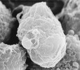 HIV na lymfocytech ve skenovacím elektronovém mikroskopu. Virové částice (viriony) jsou patrné jako drobné útvary na povrchu buněk. Foto C. Goldsmith. Převzato z Wikimedia Commons  v souladu s podmínkami použití