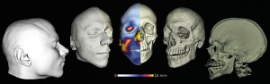 Tvrdé a měkké tkáně lidské hlavy. Díky různé míře absorpce rentgenového záření je možné měkké a tvrdé tkáně lidské hlavy segmentovat a posléze převést na povrchy reprezentované trojúhelníkovými sítěmi. Zleva: povrch kůže, průhledná kůže nad lebkou, povrch kůže barevně zobrazuje lokální tloušťku měkkých tkání, trojúhelníková síť popisující povrch lebky, průhledné zobrazení vnějších a vnitřních povrchů kostěné tkáně. Orig. J. Dupej (1. místo, Vědecká ilustrace a virtuální příroda)