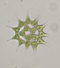 Zelená řasa Pediastrum simplex (Chlorophyta) není u nás nepůvodní,  ale dříve byla velmi vzácná, zatímco  dnes představuje řasový plevel. Foto J. Kaštovský