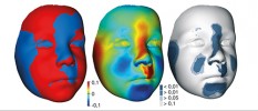 Fyziognomie obličeje u čtyřletých dětí s izolovaným rozštěpem rtu  vzhledem ke kontrolnímu souboru  zobrazená různým způsobem.  Obr. vlevo ukazuje superprojekci  (vzájemnou vzdálenost dvou povrchů  po registraci) průměrného obličeje  pacientů (modrá barva) do obličeje  kontrolních stejně starých dětí (červená). Uprostřed je vizualizace rozdílů průměrného rozštěpového a kontrolního obličeje pomocí barevné mapy rozdílů –  červená označuje místa, která mají  pacienti s vadou větší či více vpředu (střední oblast čela, mezioční vzdálenost, oblast kořene nosu, postranní část  obličeje, zjizvení horního rtu vlevo).  Obr.vpravo znázorňuje oblasti,  kde se obličej pacientů s izolovaným  rozštěpem rtu signifikantně liší  od kontrolních. Oproti již jmenovaným  místům sem patří i přední oblast tváří a brady, které jsou naopak výraznější  u kontrolních jedinců bez postižení. Originál J. Dupej a J. Velemínská
