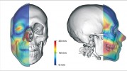 Segmentace lebky na základě  snímků z počítačové tomografie  hlavy člověka. Měkké tkáně jsou  znázorněny průsvitně jen na části  lebky a pomocí barevné mapy  je odstupňována tloušťka měkkých  tkání, zásadní pro rekonstrukci obličeje  podle lebky (vlevo pohled zepředu,  vpravo ze strany). Originál J. Dupej a J. Velemínská