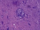 Cysta prvoka toxoplazmy Toxoplasma gondii v mozku laboratorně nakažené myši. Výzkumy na Přírodovědecké fakultě Univerzity Karlovy ukázaly, že cysty jsou dosti rovnoměrně roztroušeny téměř ve všech oblastech mozku. Z archivu J. Flegra