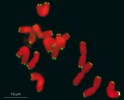Chromozomy kladivníku Cestrum elegans se signály telomerové sondy  TTTTTTAGGG. Na obr. vidíme výsledek fluorescenční hybridizace in situ (FISH). Mitotické chromozomy jsou připraveny z roztlaku kořenových špiček na podložním skle a obarveny pomocí fluorescen­ční barvy specifické pro veškerou DNA (červený signál). Nezávisle na tom  je telomerová sekvence zmnožena a označena ve zkumavce pomocí  polymerázové řetězové reakce (PCR)  a např. zeleně fluoreskující značky.  Při aplikaci takto připravené telomerové sondy na roztlaky dochází za určitých podmínek (teplota, koncentrace solí, pH atd.) k sekvenčně specifické interakci mezi sondou a chromozomy. Sonda tak označí komplementární úseky a zůstane na nich navázaná. V mikroskopu pak můžeme pozorovat místa na chromozomech, kde se sonda váže, tedy kde se nachází daná sekvence. Foto V. Peška