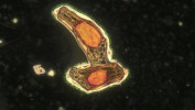 Detail semena s obarveným zárodkem. Foto K. Valentová