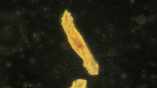 Detail semena s částečně vyvinutým zárodkem