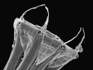 Šurpek Rogerův (O. rogeri) Pohled na peristom v elektronovém mikroskopu. Foto V. Plášek