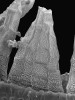 Šurpek horský (O. alpestre). V detailu ornamentace zubů exostomu s papilami, které v horní části splývají v čárkovitou strukturu typickou pro tento druh. Foto V. Plášek