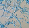 Hnojník domácí (Coprinellus domesticus, CCF 3733) se rozmnožuje i koni­diemi – artrosporami. Zvětšení 1 000×. Foto A. Kubátová