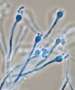 Fungikolní houba Cryptococcus depauperatus (CCF 2746) je homothalická – na myceliu tvoří jednotlivé bazidie se čtyřmi stopkami, na nichž vyrůstají v řetízcích bazidiospory. Zvětšení 1 000×. Foto A. Kubátová
