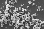 Směsná kultura archeí a bakterií zachycená elektronovou mikroskopií. Sférické a kokální buňky archeí označeny šipkou, bakteriální buňky mají  tyčinkovitý tvar. Foto A. Daebeler, Vídeňská univerzita, použito  s laskavým svolením