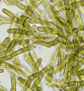 Příklady stélek zelených  půdních řas. Heterotrichální Micro­thamnion kützingianum. Foto A. Lukešová 