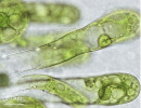 Příklady stélek zelených půdních řas. Sifonální stélka Protosiphon botryoides. Foto A. Lukešová 