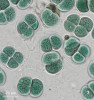 Příklady zástupců různých morfotypů a skupin cyanobakterií  (sinic) vyskytujících se v půdě. Typ kokální – Chroococcus sp.  (Chroococcales). Foto A. Lukešová