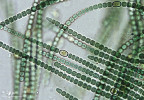 Příklady zástupců různých morfotypů a skupin cyanobakterií  (sinic) vyskytujících se v půdě.  Typ heterocytózní (tvoří silnostěnné nezelené buňky – heterocyty, obsahující enzym nitrogenázu), jednoduchý vláknitý – Trichormus variabilis (Nostocales). Foto A. Lukešová
