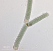 Příklady zástupců různých morfotypů a skupin cyanobakterií  (sinic) vyskytujících se v půdě. Typ heterocytózní s nepravým větvením (u heterocytů) – Tolypothrix sp. (Nostocales). Foto A. Lukešová