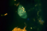 Příkladem složitých vztahů mezi půdními bezobratlými a mikroorganismy je anaerobní nálevník Nyctotherus velox (předchozí obr.), žijící v trávicím traktu tropické mnohonožky Archispirostreptus gigas. Za jeho namodralé světélkování pod UV světlem je zodpovědná  chemická látka F420, která slouží jako koenzym v metabolismu metanogenních  mikroorganismů z domény Archaea.  