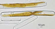 Zralé auxospory rodu Pinnularia, obklopené prázdnými schránkami rodičovských buněk. Foto A. Poulíčková